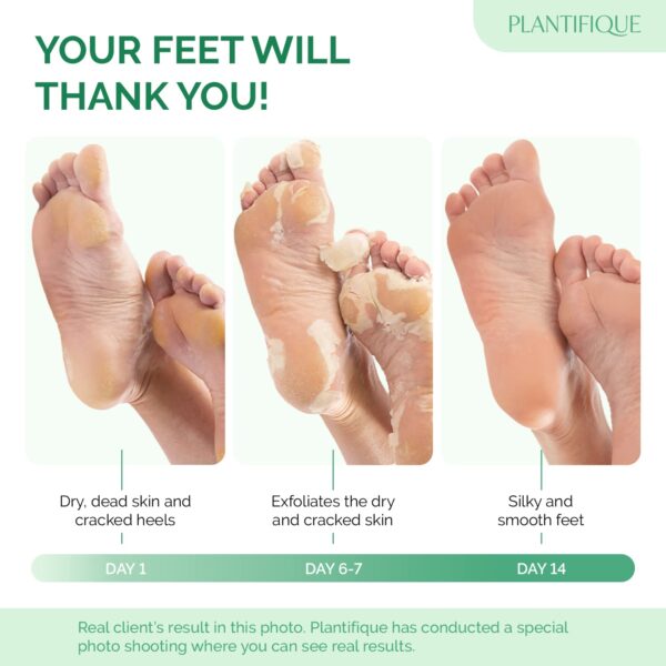 PLANTIFIQUE Foot Peeling Mask (2 Pairs) - Peeling Foot - Image 4