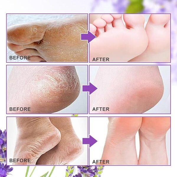 ALIVER Foot Peel Mask 3 Pack, Exfoliator Peel Off Calluses - Image 3
