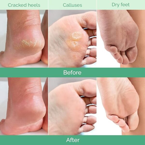 PLANTIFIQUE Foot Peeling Mask (2 Pairs) - Peeling Foot - Image 2